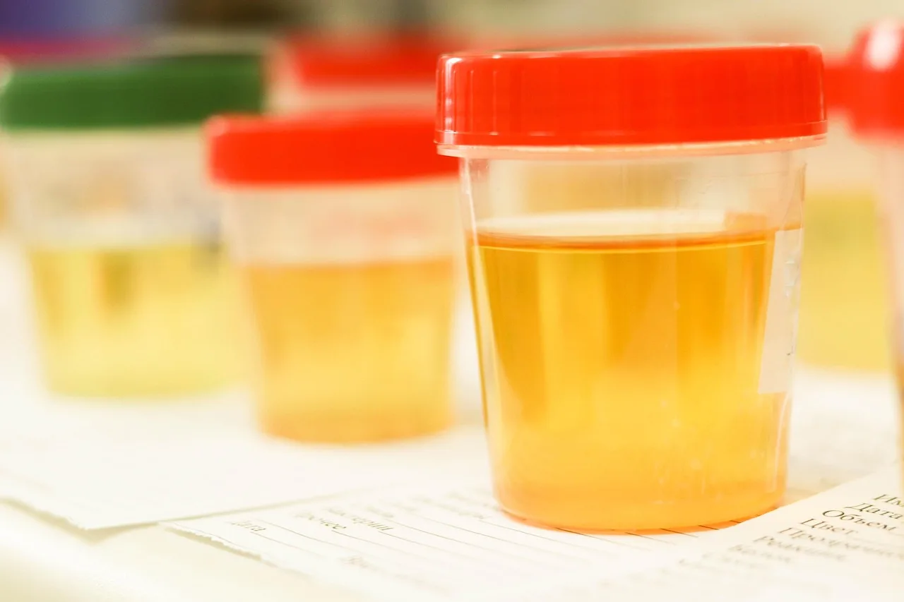 Vektnedgang som faktisk holder seg